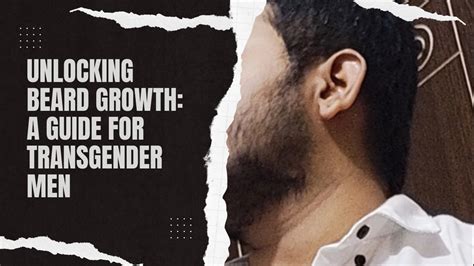 ftm hair|Unlocking Beard Growth: A Guide for Transgender Men –.